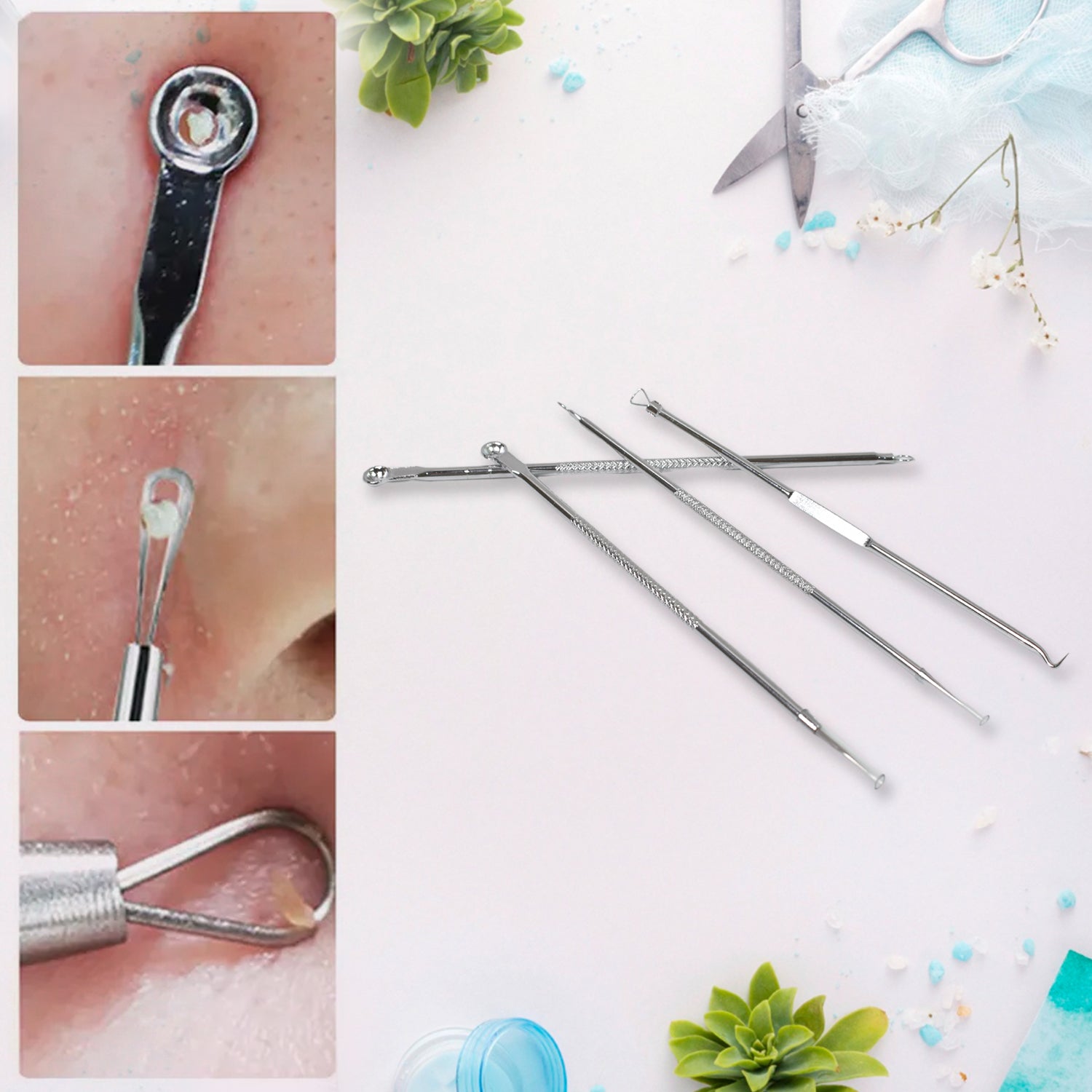 Facial Pimple Extractor Kit Facial Pimple Extractor Kit